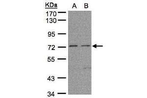 WB Image Sample (30μg whole cell lysate) A: H1299 B: HeLa S3, 7. (FLRT1 抗体)