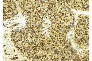 Immunohistochemistry (IHC) image for anti-Estrogen Receptor 1 (ESR1) (C-Term) antibody (ABIN6261610)