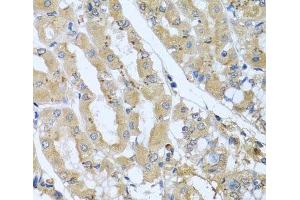 Immunohistochemistry of paraffin-embedded Human stomach using STX7 Polyclonal Antibody at dilution of 1:100 (40x lens). (Syntaxin 7 抗体)
