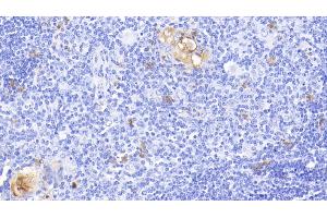Immunohistochemistry (IHC) image for anti-S100 Calcium Binding Protein A12 (S100A12) (AA 2-92) antibody (ABIN7444682)