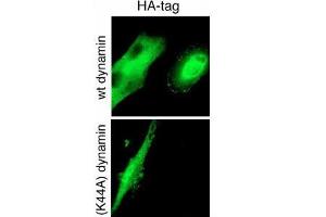 GTPase activity of dynamin-2 is required for endocytosis of cell-surface tTG. (HA-Tag 抗体)