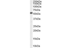 Image no. 1 for anti-Zinc Metalloproteinase, Ste24 (Zmpste24) (C-Term) antibody (ABIN374738) (ZMPSTE24 抗体  (C-Term))
