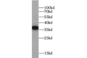 Western blot analysis of HeLa cells subjected to SDS-PAGE, using FOLR1 antibody (1/1000 dilution).