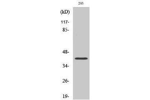Western Blotting (WB) image for anti-SUMO1 Activating Enzyme Subunit 1 (SAE1) (Internal Region) antibody (ABIN3186870) (SAE1 抗体  (Internal Region))