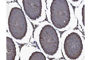 IHC analysis of SEC14L3/TAP2 using anti-SEC14L3/TAP2 antibody (ABIN7601623).