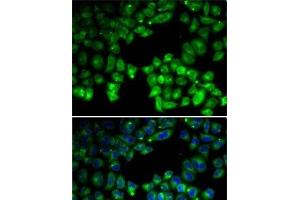 Immunofluorescence analysis of U2OS cells using NEIL1 Polyclonal Antibody (NEIL1 抗体)