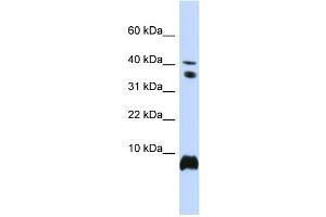 WB Suggested Anti-HMGN1 Antibody Titration:  0. (HMGN1 抗体  (Middle Region))
