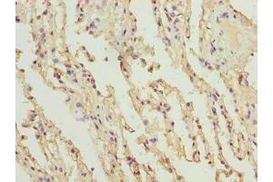 Immunohistochemistry of paraffin-embedded human lung tissue using ABIN7148227 at dilution of 1:100 (COL12A1 抗体  (AA 140-316))