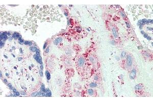 Detection of PRG4 in Human Placenta Tissue using Polyclonal Antibody to Proteoglycan 4 (PRG4)