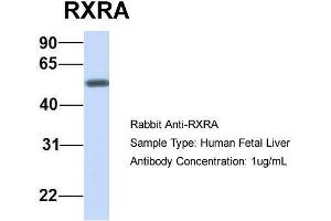 Host:  Rabbit  Target Name:  RXRA  Sample Type:  Human Fetal Liver  Antibody Dilution:  1. (Retinoid X Receptor alpha 抗体  (N-Term))