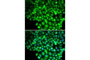 Immunofluorescence analysis of HeLa cells using ALOX15B antibody. (ALOX15B 抗体)
