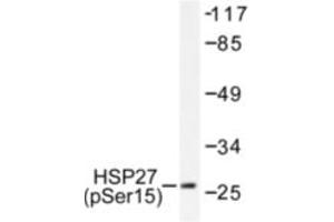 Image no. 1 for anti-Heat Shock 27kDa Protein 1 (HSPB1) (pSer15) antibody (ABIN318042) (HSP27 抗体  (pSer15))