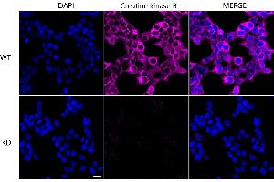 Immunocytochemical staining of HeLa cells using Creatine kinase B antibody (ABIN7798162), 1:1,000), Top panel: wild-type (WT), Bottom panal: Creatine kinase B shRNA knockdown (KD). (Recombinant CKB 抗体)