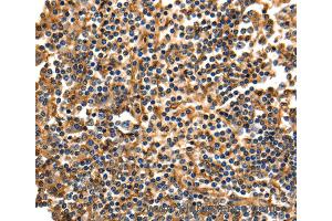 Immunohistochemistry of Human tonsil using ANXA5 Polyclonal Antibody at dilution of 1:40 (Annexin V 抗体)