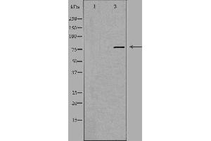 Western blot analysis of extracts from A549 cells, using EHHADH antibody. (EHHADH 抗体  (Internal Region))