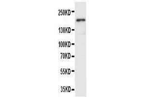 Anti-VEGF Receptor 2 antibody, Western blotting WB: SMMC Cell Lysate