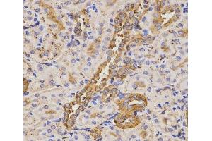 Immunohistochemistry of paraffin-embedded Rat kidney using KLK5 Polyclonal Antibody at dilution of 1:200 (40x lens). (Kallikrein 5 抗体)
