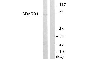 Western blot analysis of extracts from HepG2 cells, using ADARB1 antibody. (RED1 抗体)