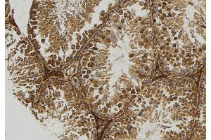 ABIN6277667 at 1/100 staining Mouse testis tissue by IHC-P. (TPP1 抗体  (Internal Region))