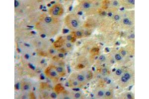IHC-P analysis of Liver tissue, with DAB staining. (SLC30A8 抗体  (AA 263-369))