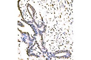 anti-Protein Virilizer Homolog (VIRMA) (AA 11-1529) antibody