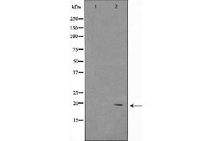 Western blot analysis of ASH2 using 293 whole cell lysates (ASH2L 抗体  (Internal Region))