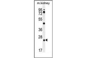 Western blot analysis of PGPEP1 Antibody (N-term) in mouse kidney tissue lysates (35ug/lane). (PGPEP1 抗体  (N-Term))
