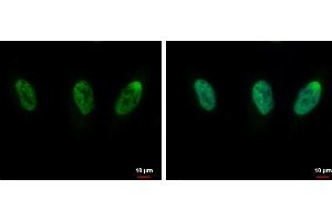 ICC/IF Image CIP29 antibody [N1C3] detects CIP29 protein at nucleus by immunofluorescent analysis. (SARNP 抗体)