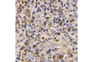 Immunohistochemistry (IHC) image for anti-ATP-Binding Cassette, Sub-Family A (ABC1), Member 6 (ABCA6) antibody (ABIN1870712) (ABCA6 抗体)