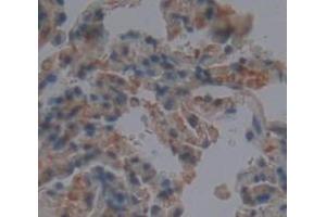 IHC-P analysis of Human Tissue, with DAB staining. (CLEC3B 抗体  (AA 22-202))