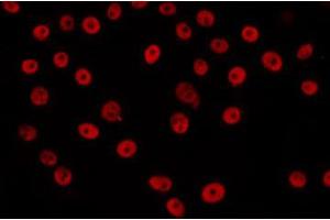 ABIN6266650 staining LOVO by IF/ICC. (HAT1 抗体  (C-Term))