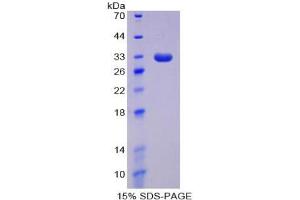 SDS-PAGE analysis of Human DNMT1 Protein. (DNMT1 蛋白)