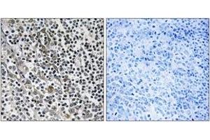 Immunohistochemistry analysis of paraffin-embedded human tonsil tissue, using MRPL51 Antibody. (MRPL51 抗体  (AA 51-100))