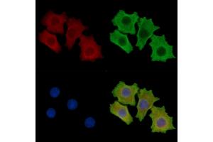 ABIN7095688 and ABIN7099750 staining HepG2 cells by IF/ICC. (ASIC3 抗体)