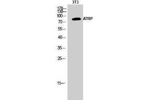 Western Blotting (WB) image for anti-ATR Interacting Protein (ATRIP) (Tyr783) antibody (ABIN3179886) (ATRIP 抗体  (Tyr783))