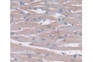Immunohistochemistry (IHC) image for anti-Interleukin 24 (IL24) (AA 29-183) antibody (ABIN7427543)
