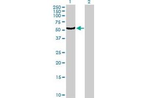 Western Blotting (WB) image for anti-Cytochrome P450, Family 4, Subfamily B, Polypeptide 1 (CYP4B1) (AA 1-512) antibody (ABIN514844)