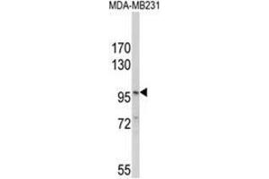 Western blot analysis of NLRP3 Antibody (N-term) in MDA-MB231 cell line lysates (35ug/lane). (NLRP3 抗体  (N-Term))