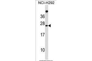 DU1 Antibody (C-term) (ABIN1881550 and ABIN2839061) western blot analysis in NCI- cell line lysates (35 μg/lane). (MPDU1 抗体  (C-Term))