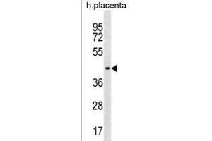 ZN Antibody (C-term) (ABIN1537259 and ABIN2838224) western blot analysis in human placenta tissue lysates (35 μg/lane). (ZNF662 抗体  (C-Term))