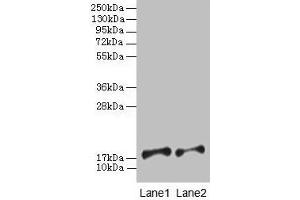 Western blot All lanes: PFDN5 antibody at 2 μg/mL Lane 1: EC109 whole cell lysate Lane 2: 293T whole cell lysate Secondary Goat polyclonal to rabbit IgG at 1/15000 dilution Predicted band size: 18, 8, 13 kDa Observed band size: 18 kDa (PFDN5 抗体  (AA 2-154))