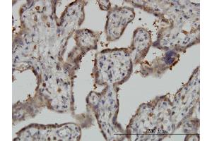 Immunoperoxidase of monoclonal antibody to NT5C2 on formalin-fixed paraffin-embedded human placenta. (NT5C2 抗体  (AA 1-561))