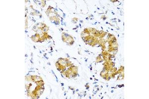 Immunohistochemistry of paraffin-embedded human stomach using WFDC2 antibody at dilution of 1:100 (40x lens).