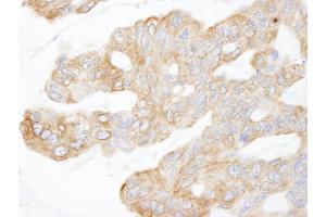 Immunohistochemistry (IHC) image for anti-KIAA1524 (KIAA1524) (AA 550-600) antibody (ABIN7448939)