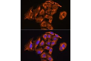 Immunofluorescence analysis of U2OS cells using Thioredoxin reductase 2 (TXNRD2 ) antibody (ABIN6128856, ABIN6149741, ABIN6149742 and ABIN6221158) at dilution of 1:100. (TXNRD2 抗体  (AA 100-310))