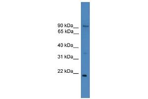 WB Suggested Anti-FOXM1 Antibody Titration:  1 ug/ml  Positive Control:  THP-1 cell lysate (FOXM1 抗体  (N-Term))
