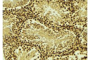 ABIN6276529 at 1/100 staining Mouse testis tissue by IHC-P. (CRADD 抗体  (Internal Region))