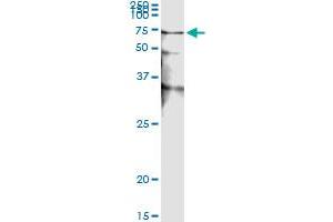 Immunoprecipitation (IP) image for anti-serine/threonine Kinase 38 (STK38) (AA 1-466) antibody (ABIN599179) (STK38 抗体  (AA 1-466))