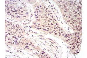Immunohistochemistry (IHC) image for anti-Eukaryotic Translation Initiation Factor 5A (EIF5A) (AA 1-154) antibody (ABIN5542611)