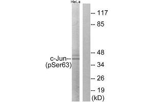 Western Blotting (WB) image for anti-Jun Proto-Oncogene (JUN) (pSer63) antibody (ABIN1847456) (C-JUN 抗体  (pSer63))